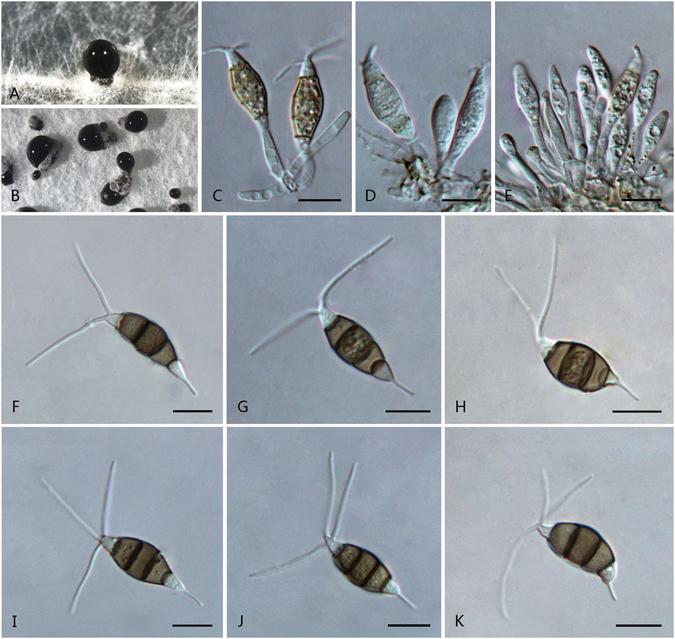 https://cdn.ncbi.nlm.nih.gov/pmc/blobs/627c/5429834/ed236ec5f7ba/41598_2017_972_Fig12_HTML.jpg
