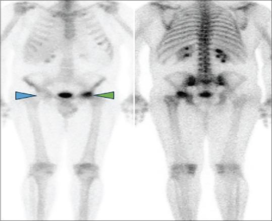 https://cdn.ncbi.nlm.nih.gov/pmc/blobs/627d/11404732/8181b03d1f53/IJNM-39-207-g002.jpg