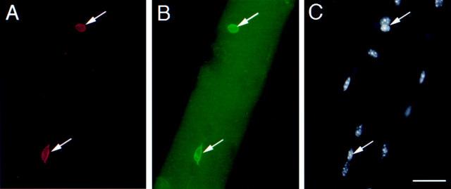https://cdn.ncbi.nlm.nih.gov/pmc/blobs/6280/2190588/8fbdc5e722a7/JCB0004041.f4.jpg