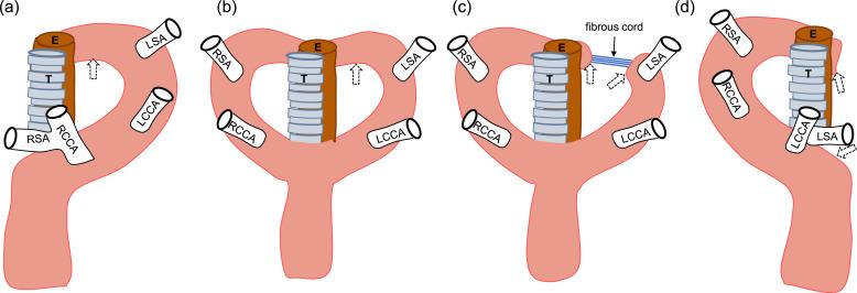 https://cdn.ncbi.nlm.nih.gov/pmc/blobs/6289/11133496/203760101fde/gr1.jpg