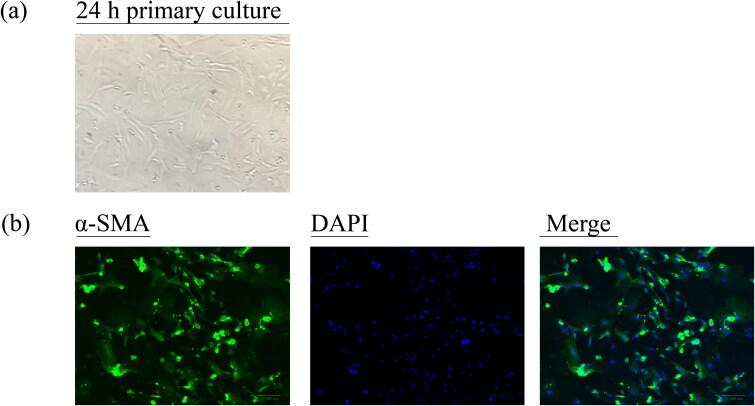 https://cdn.ncbi.nlm.nih.gov/pmc/blobs/6296/9897790/ffbc907c0a50/IPHB_A_2173249_F0007_C.jpg