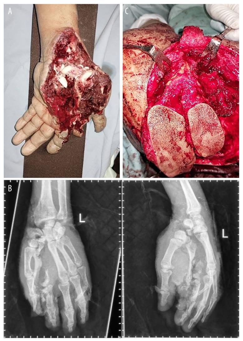 https://cdn.ncbi.nlm.nih.gov/pmc/blobs/6297/11638736/46e65015a7f5/amjcaserep-25-e945759-g001.jpg