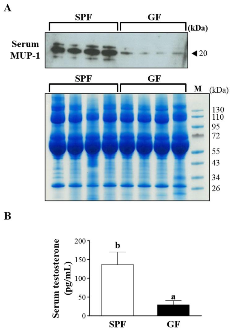 https://cdn.ncbi.nlm.nih.gov/pmc/blobs/629a/5370288/1b9ee26320af/ijmsv14p0257g003.jpg
