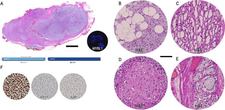 https://cdn.ncbi.nlm.nih.gov/pmc/blobs/629f/8081865/d4b95d453d80/gr4.jpg