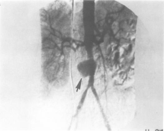 https://cdn.ncbi.nlm.nih.gov/pmc/blobs/62a1/324723/390f0a9c0771/thij00064-0104-a.jpg