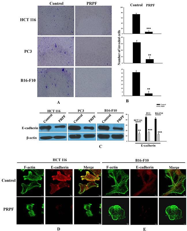 https://cdn.ncbi.nlm.nih.gov/pmc/blobs/62a4/5593591/ca3514e27e0f/oncotarget-08-56659-g005.jpg