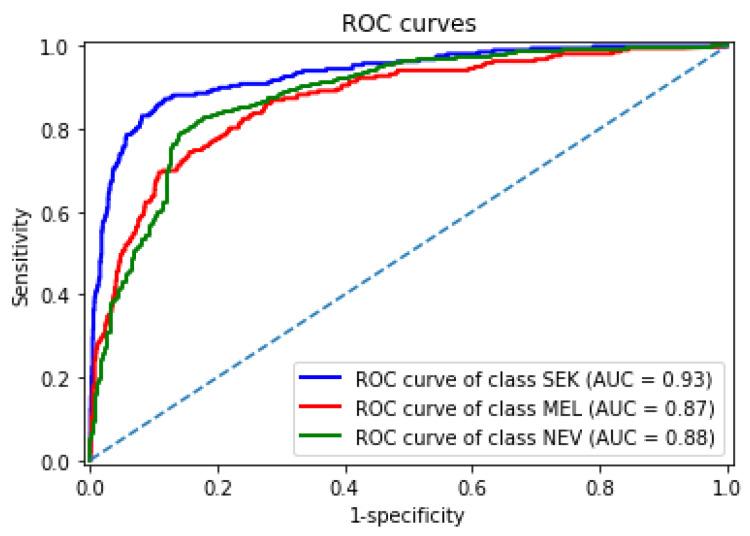 https://cdn.ncbi.nlm.nih.gov/pmc/blobs/62a4/8229112/73a2968449dd/sensors-21-03999-g008.jpg