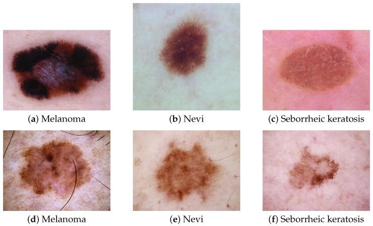 https://cdn.ncbi.nlm.nih.gov/pmc/blobs/62a4/8229112/cc93b2b59384/sensors-21-03999-g001.jpg