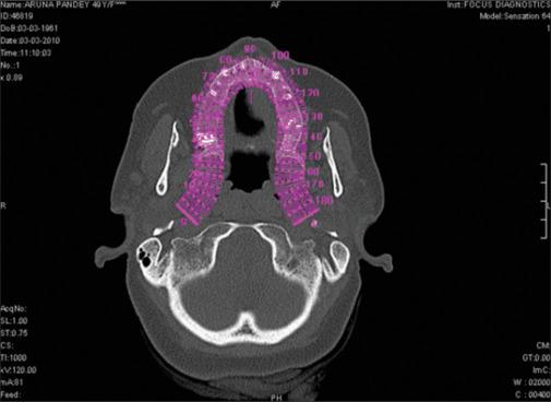 https://cdn.ncbi.nlm.nih.gov/pmc/blobs/62a5/12156841/3a9595567aeb/NJMS-16-126-g001.jpg