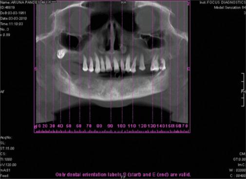 https://cdn.ncbi.nlm.nih.gov/pmc/blobs/62a5/12156841/daae85a0deb4/NJMS-16-126-g002.jpg