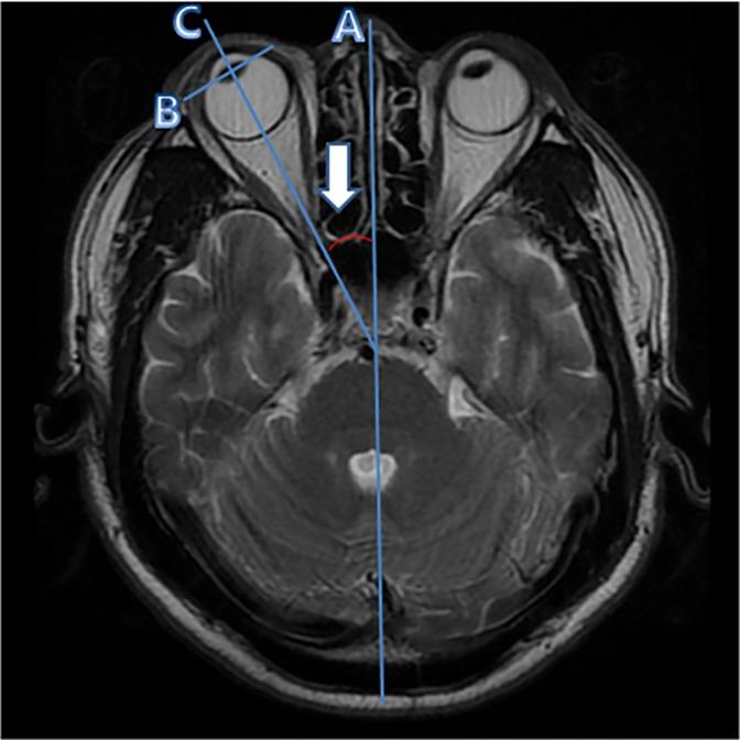 https://cdn.ncbi.nlm.nih.gov/pmc/blobs/62a6/6822736/9f2a6994674c/pone.0224605.g001.jpg