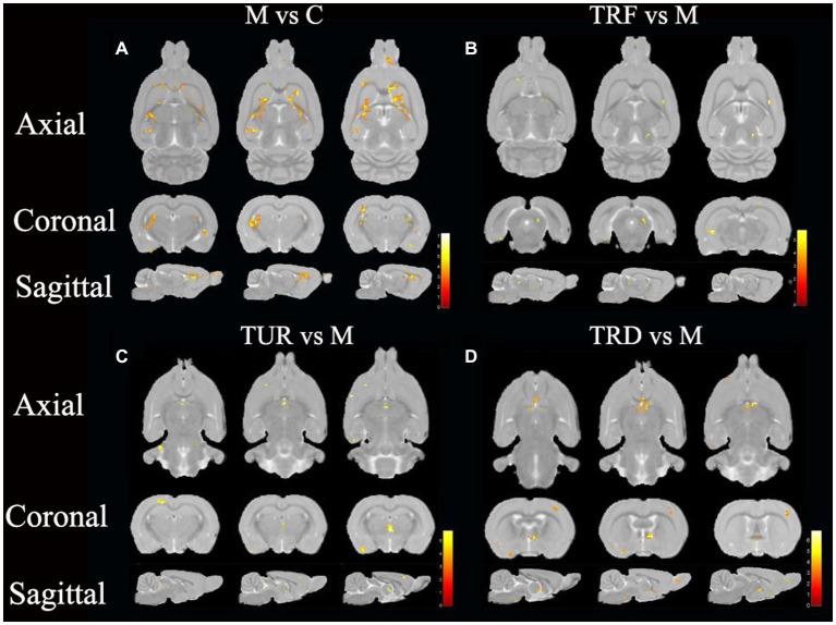 https://cdn.ncbi.nlm.nih.gov/pmc/blobs/62a8/10250630/1439746311e6/fnins-17-1161578-g003.jpg