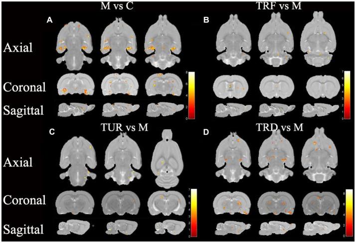 https://cdn.ncbi.nlm.nih.gov/pmc/blobs/62a8/10250630/7097398b01a9/fnins-17-1161578-g004.jpg