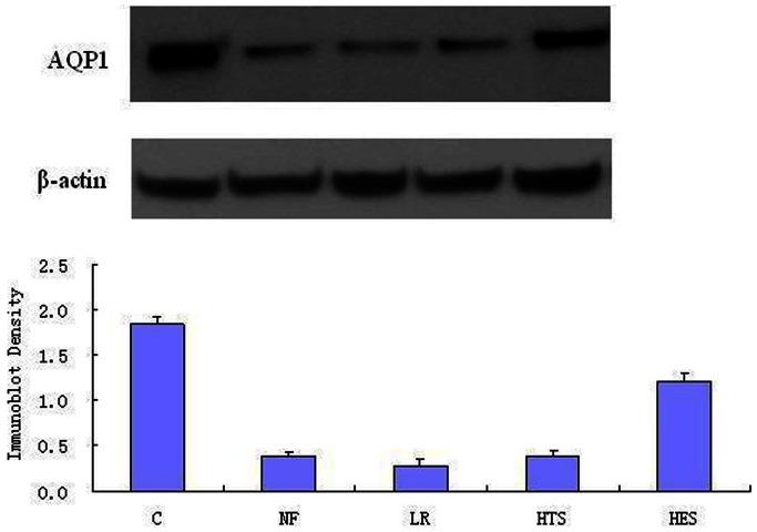 https://cdn.ncbi.nlm.nih.gov/pmc/blobs/62b3/3669317/33e08a2698ed/pone.0064390.g001.jpg