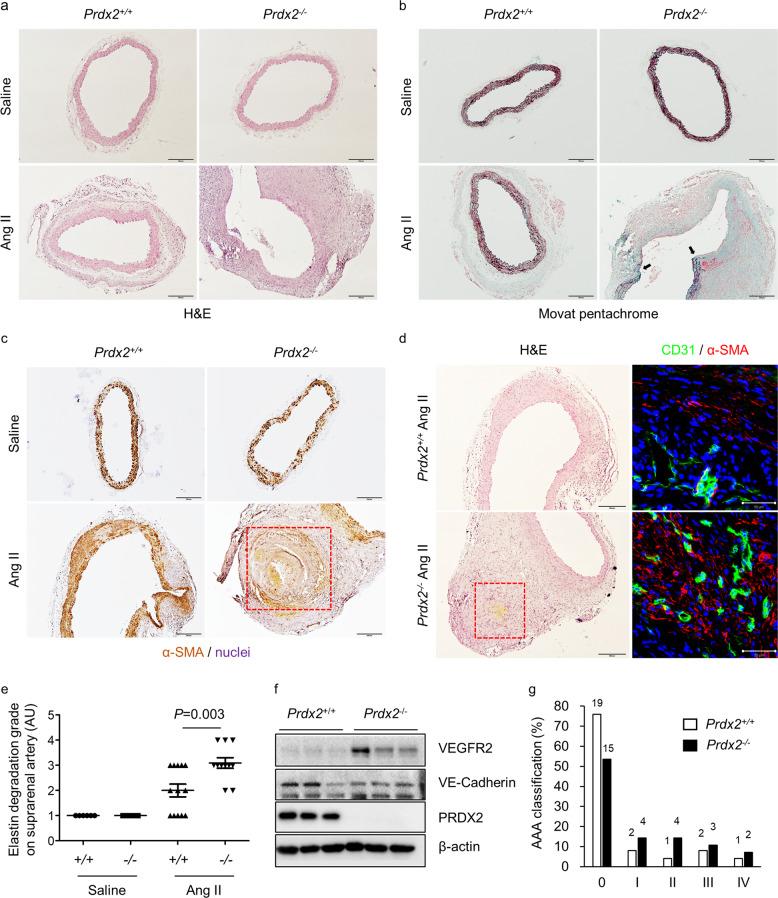 https://cdn.ncbi.nlm.nih.gov/pmc/blobs/62b8/8080566/6be8c22f99e7/12276_2020_498_Fig4_HTML.jpg