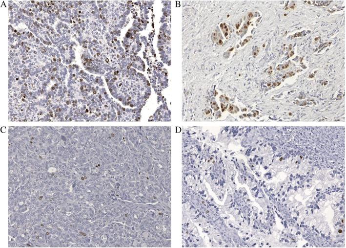 https://cdn.ncbi.nlm.nih.gov/pmc/blobs/62b9/6373097/b602442ea88f/13048_2019_492_Fig1_HTML.jpg