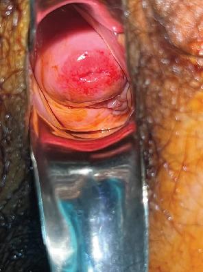 https://cdn.ncbi.nlm.nih.gov/pmc/blobs/62bb/12133356/944b3867a7ba/CRIOG2025-5513823.001.jpg