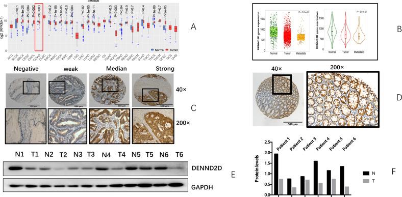 https://cdn.ncbi.nlm.nih.gov/pmc/blobs/62c7/9076603/413060139c82/41419_2022_4885_Fig1_HTML.jpg