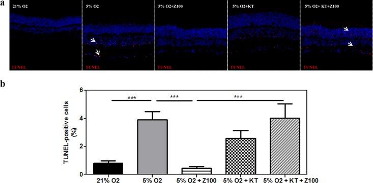 https://cdn.ncbi.nlm.nih.gov/pmc/blobs/62c9/5115799/02d6c9bd76e5/pone.0166717.g002.jpg