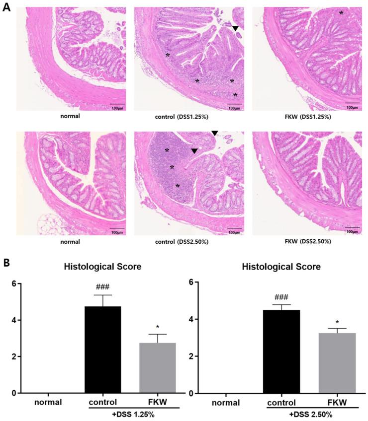 https://cdn.ncbi.nlm.nih.gov/pmc/blobs/62cd/11988869/9c4e2186600c/ijms-26-03017-g003.jpg