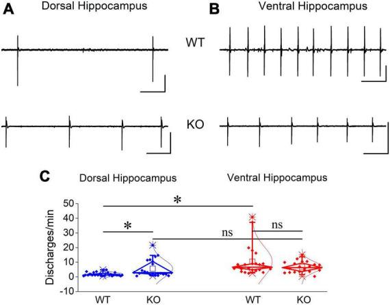 https://cdn.ncbi.nlm.nih.gov/pmc/blobs/62cf/10722241/fa75368a680a/fncel-17-1296235-g011.jpg