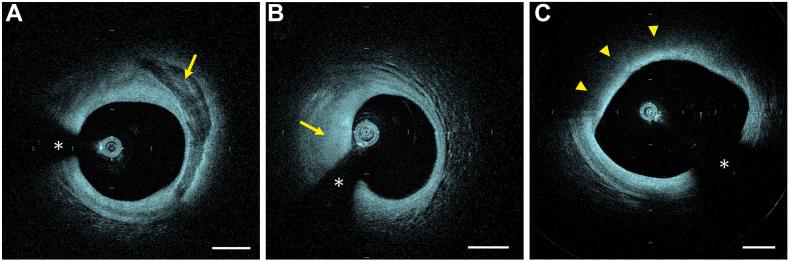 https://cdn.ncbi.nlm.nih.gov/pmc/blobs/62d0/11993863/46460dddda3d/gr2.jpg