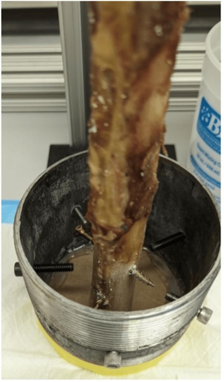 https://cdn.ncbi.nlm.nih.gov/pmc/blobs/62d2/11793836/842f972de340/cureus-0017-00000076918-i04.jpg