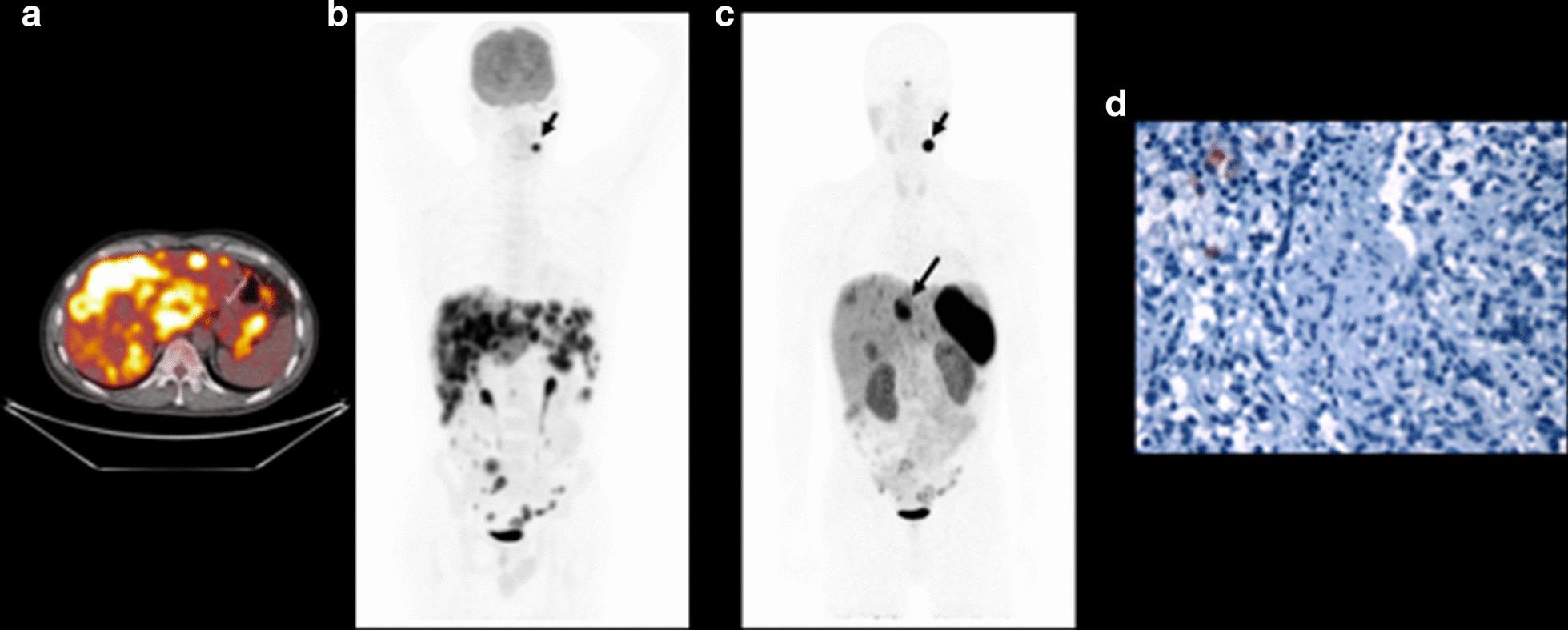 https://cdn.ncbi.nlm.nih.gov/pmc/blobs/62d2/7809083/5453d0cf4487/13550_2021_747_Fig3_HTML.jpg