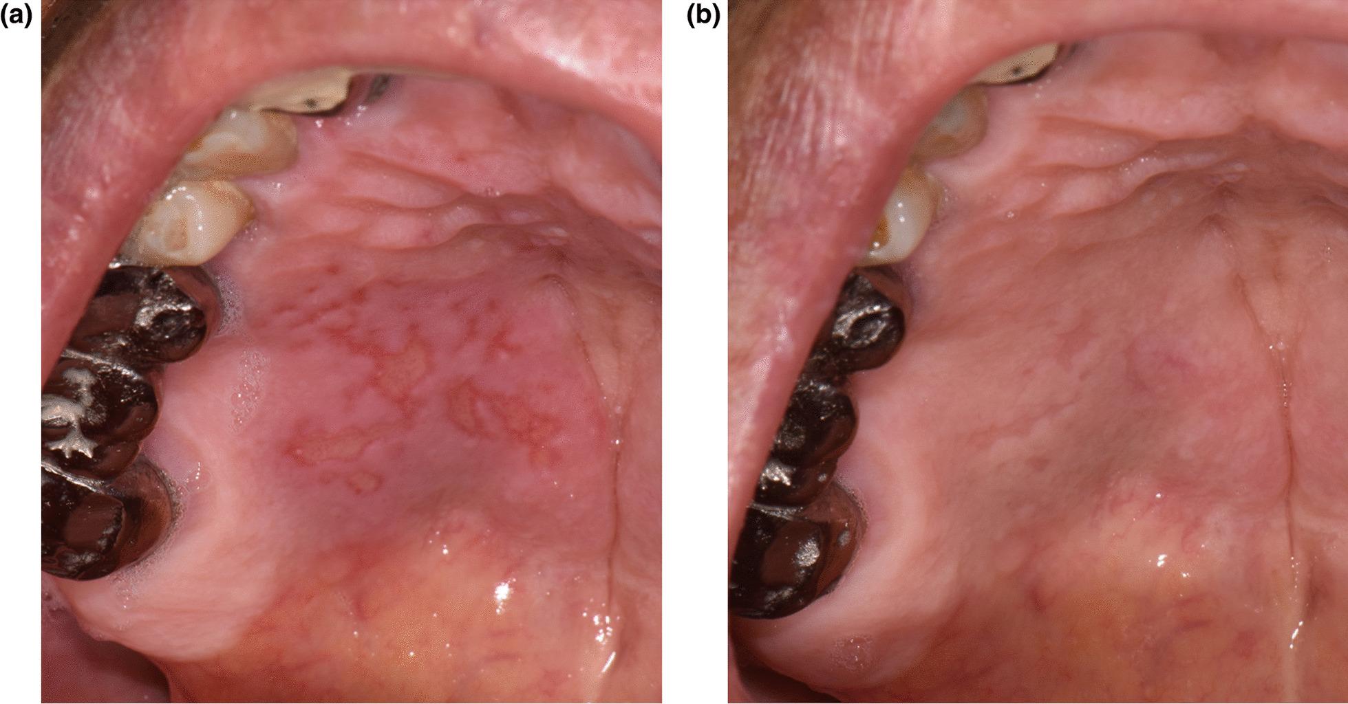 https://cdn.ncbi.nlm.nih.gov/pmc/blobs/62d4/8905867/1e0e5b5dadc3/12903_2022_2100_Fig1_HTML.jpg