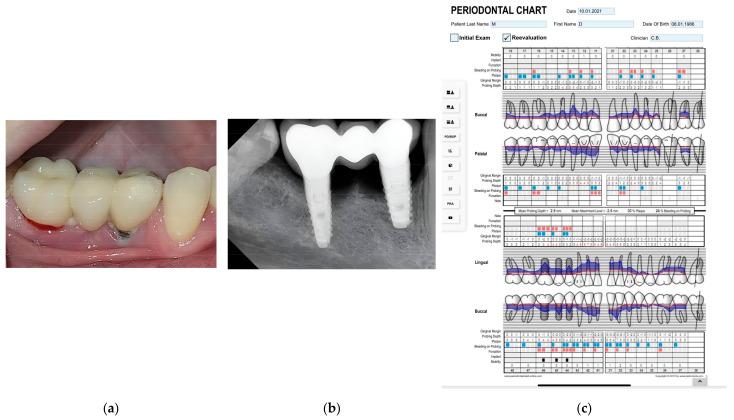 https://cdn.ncbi.nlm.nih.gov/pmc/blobs/62d6/11275279/75cc0ff3f543/diagnostics-14-01573-g001.jpg