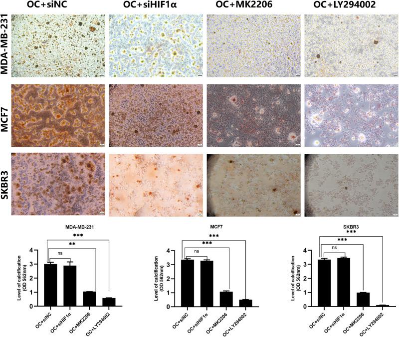 https://cdn.ncbi.nlm.nih.gov/pmc/blobs/62d7/10643473/bb9311a48d83/41523_2023_598_Fig5_HTML.jpg