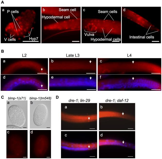 https://cdn.ncbi.nlm.nih.gov/pmc/blobs/62d7/4072510/5ec5f6318232/pgen.1004428.g004.jpg