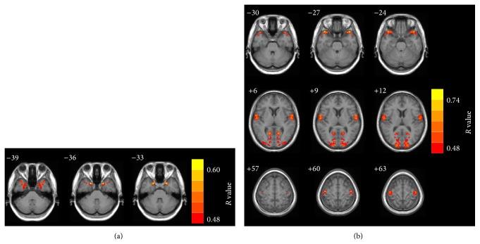 https://cdn.ncbi.nlm.nih.gov/pmc/blobs/62d8/4350869/4a2a753c5935/BMRI2015-345647.002.jpg