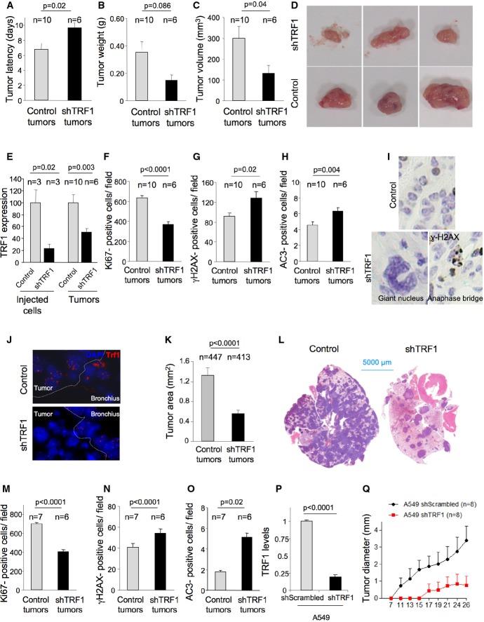 https://cdn.ncbi.nlm.nih.gov/pmc/blobs/62da/4520658/791cdd808baf/emmm0007-0930-f5.jpg