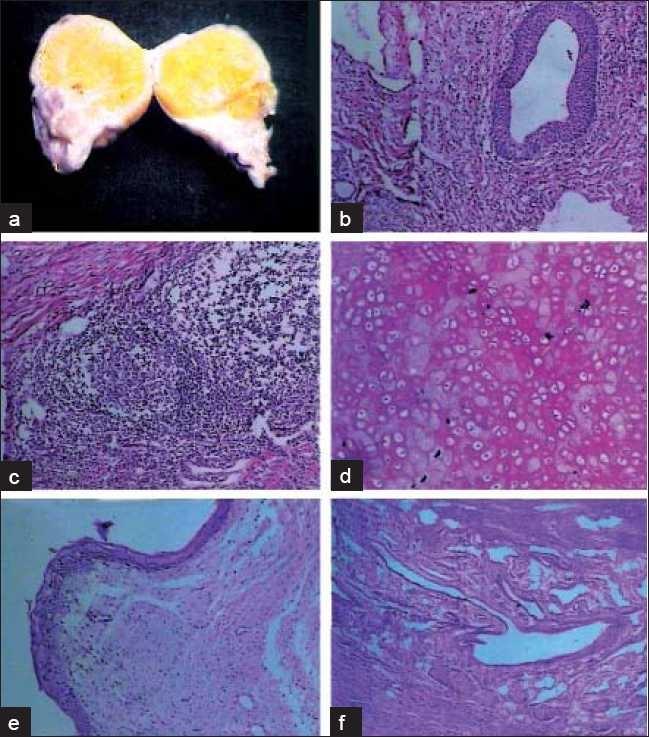 https://cdn.ncbi.nlm.nih.gov/pmc/blobs/62db/3099088/78ba946f9cd4/SJG-17-74-g002.jpg