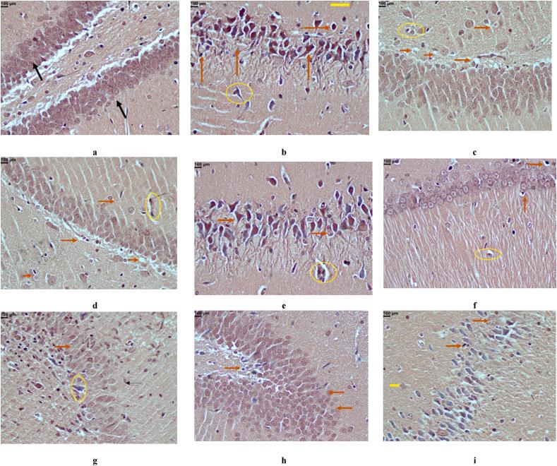 https://cdn.ncbi.nlm.nih.gov/pmc/blobs/62e0/11068997/5448dfcf9eca/gr6a.jpg