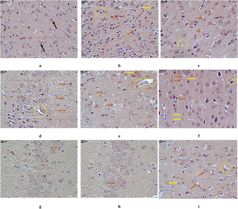 https://cdn.ncbi.nlm.nih.gov/pmc/blobs/62e0/11068997/95e0dc2b9395/gr6b.jpg