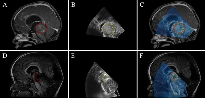 https://cdn.ncbi.nlm.nih.gov/pmc/blobs/62e0/11322494/6f4382a8fdb6/381_2024_6492_Fig4_HTML.jpg