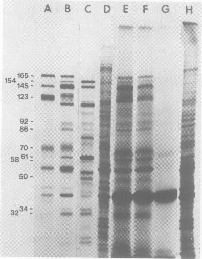 https://cdn.ncbi.nlm.nih.gov/pmc/blobs/62e3/353501/da4773b344e6/jvirol00189-0168-a.jpg
