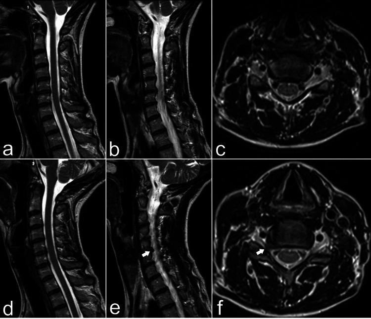 https://cdn.ncbi.nlm.nih.gov/pmc/blobs/62eb/12126252/a1d660e0d876/cureus-0017-00000083321-i02.jpg