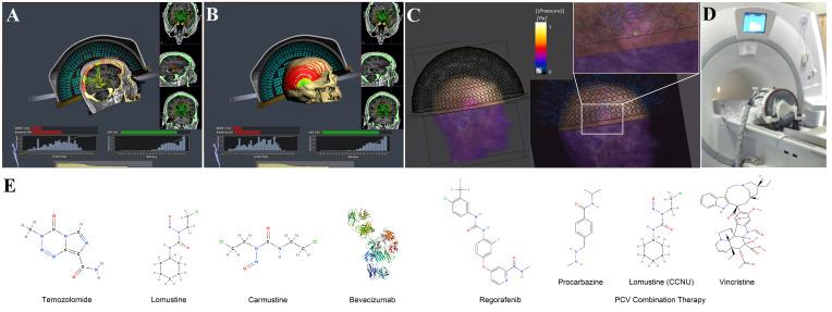https://cdn.ncbi.nlm.nih.gov/pmc/blobs/62ed/11965939/bc903c28df5f/fonc-15-1507940-g001.jpg