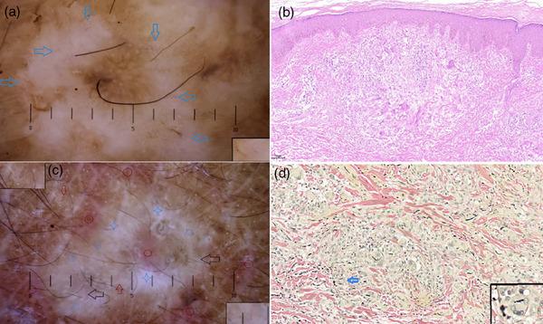 https://cdn.ncbi.nlm.nih.gov/pmc/blobs/6306/11452252/4dc703f3f1bb/SRT-30-e70067-g003.jpg