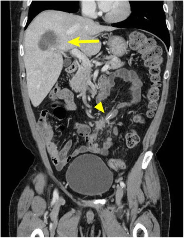 https://cdn.ncbi.nlm.nih.gov/pmc/blobs/6315/7275410/d84847c868f7/12893_2020_783_Fig1_HTML.jpg