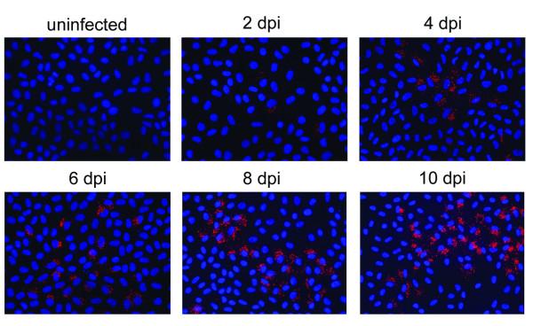 https://cdn.ncbi.nlm.nih.gov/pmc/blobs/631d/3145595/9e0a549b555f/1743-422X-8-339-4.jpg