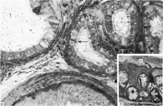 https://cdn.ncbi.nlm.nih.gov/pmc/blobs/6321/1231898/39018d323530/janat00369-0035-b.jpg
