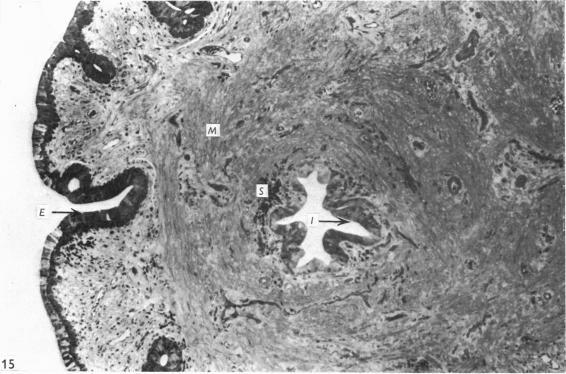 https://cdn.ncbi.nlm.nih.gov/pmc/blobs/6321/1231898/6c0c28ecdd2e/janat00369-0041-a.jpg