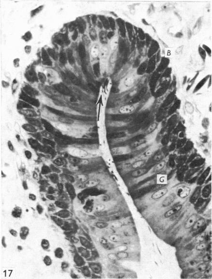 https://cdn.ncbi.nlm.nih.gov/pmc/blobs/6321/1231898/6ccaf5668a3d/janat00369-0041-c.jpg