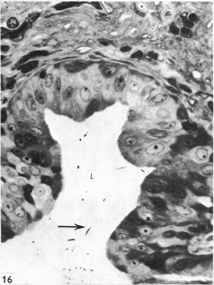 https://cdn.ncbi.nlm.nih.gov/pmc/blobs/6321/1231898/9c91b7e62adb/janat00369-0041-b.jpg