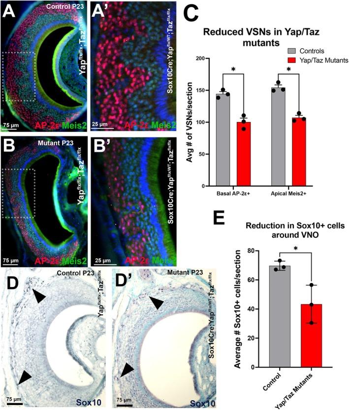 https://cdn.ncbi.nlm.nih.gov/pmc/blobs/6327/12334863/d89f79ecb4bd/GLIA-73-2077-g004.jpg