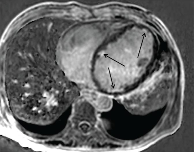 https://cdn.ncbi.nlm.nih.gov/pmc/blobs/6327/5600024/fdd1fd8bbfbe/mrms-16-183-g5.jpg